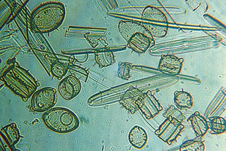 Illustration for article titled Species Of Blue-Green Algae Announces IPO